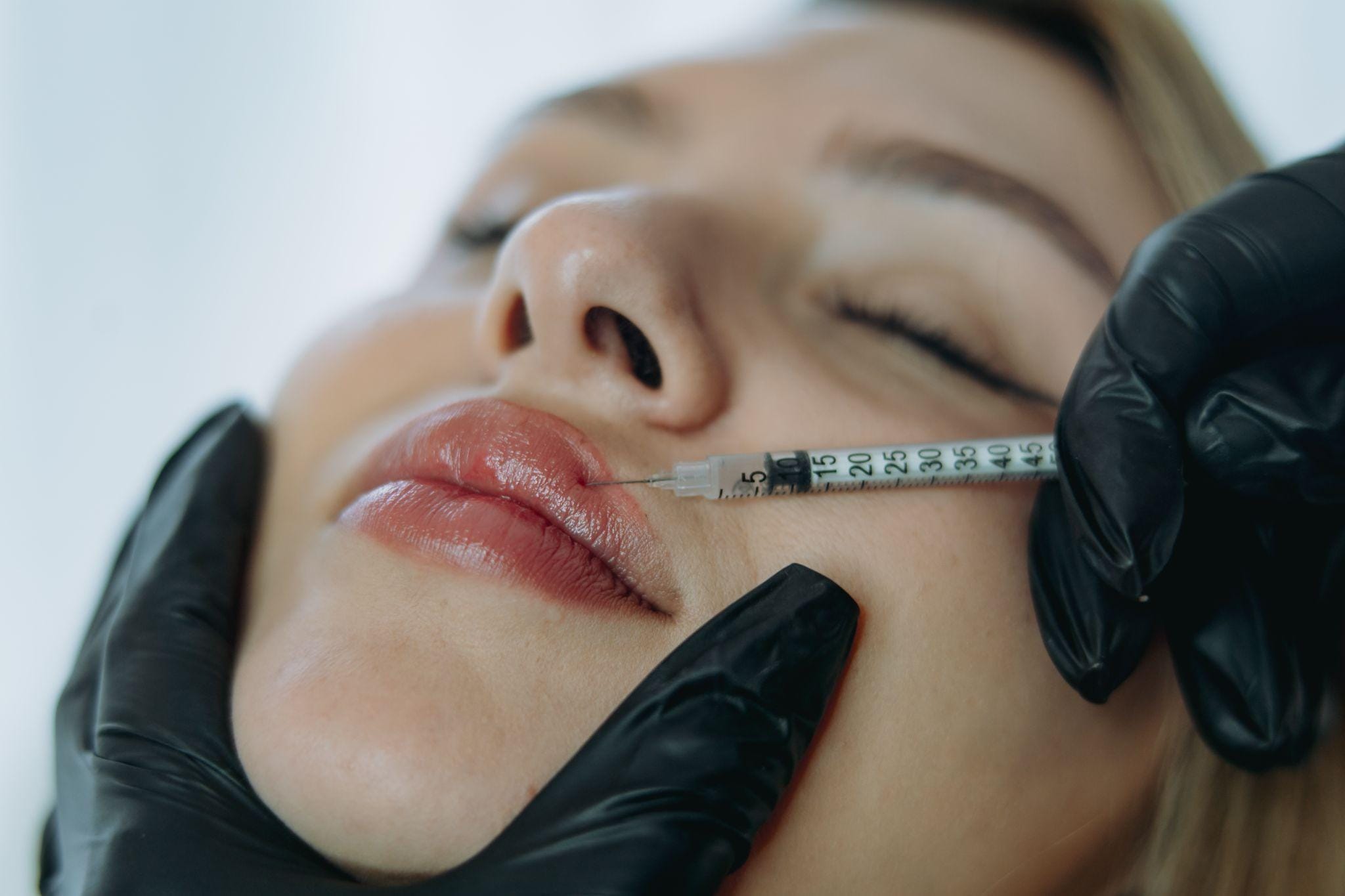 Achieve Fuller Lips with Lip Fillers in Fort Lauderdale at The Fort Lauderdale Med Spa in Fort Lauderdale