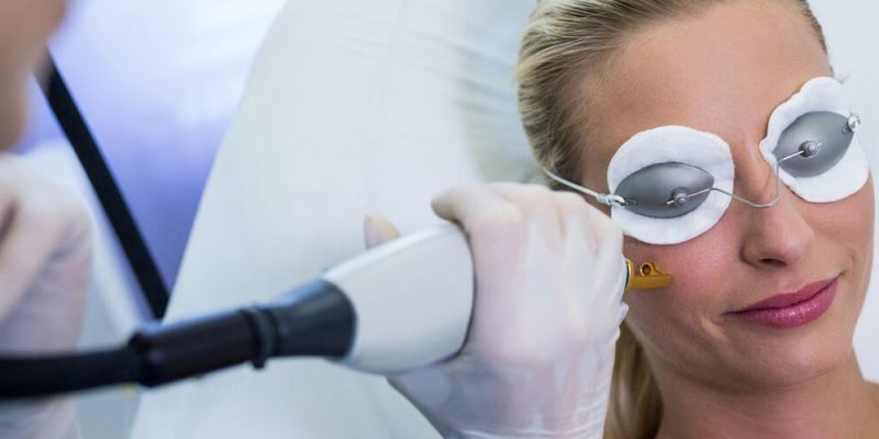 CoolPeel-CO2-laser