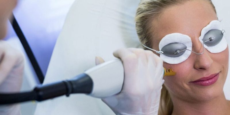 CoolPeel CO2 laser resurfacing treatment image